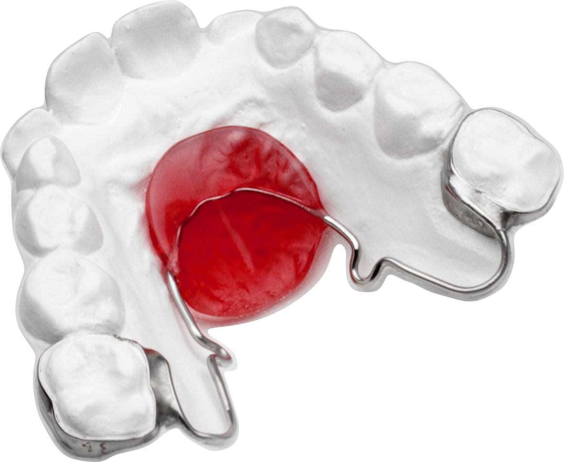 Ring retainers